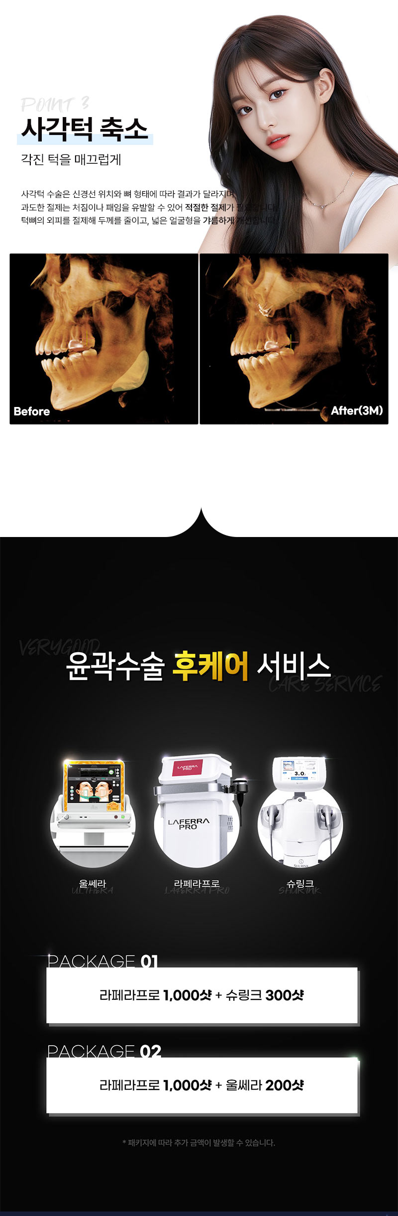 베리굿성형외과의원 윤곽의신 안면윤곽 이벤트, 시술 상세 이미지