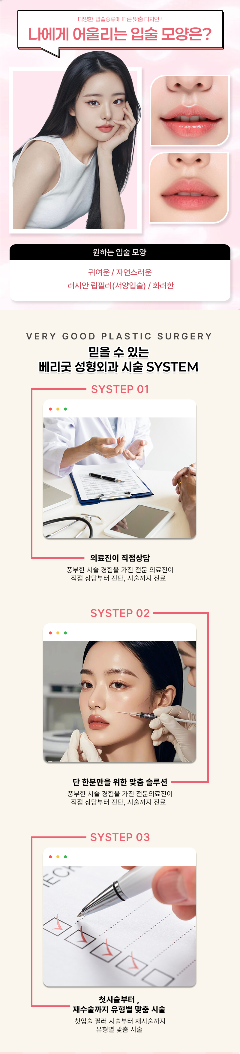 베리굿성형외과의원 베리굿 커스텀 벨벳 입술필러 이벤트, 시술 상세 이미지