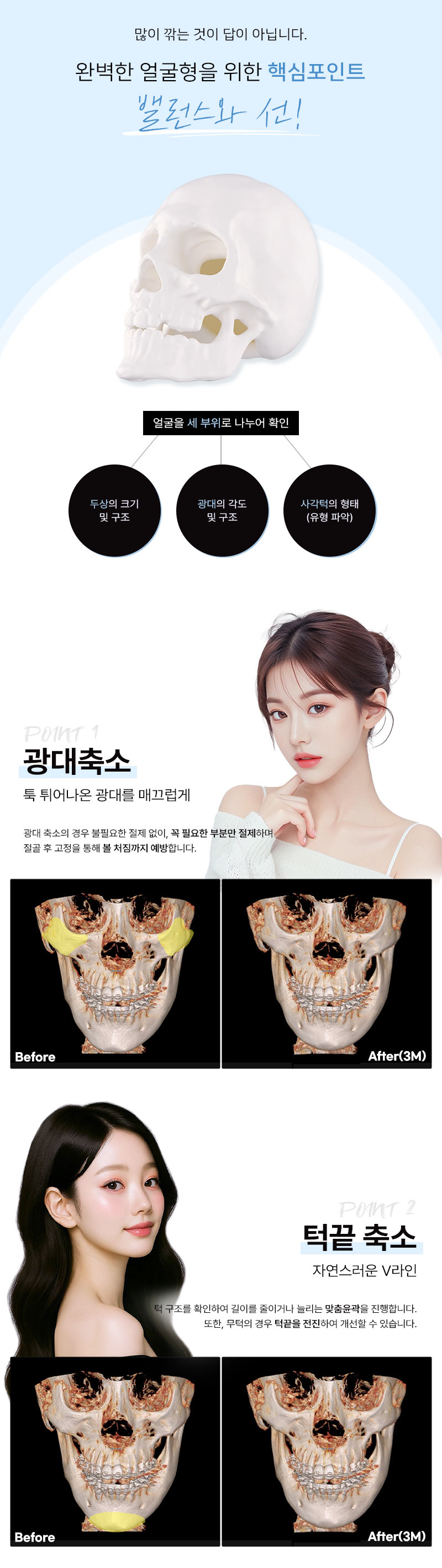 베리굿성형외과의원 윤곽의신 안면윤곽 이벤트, 시술 상세 이미지