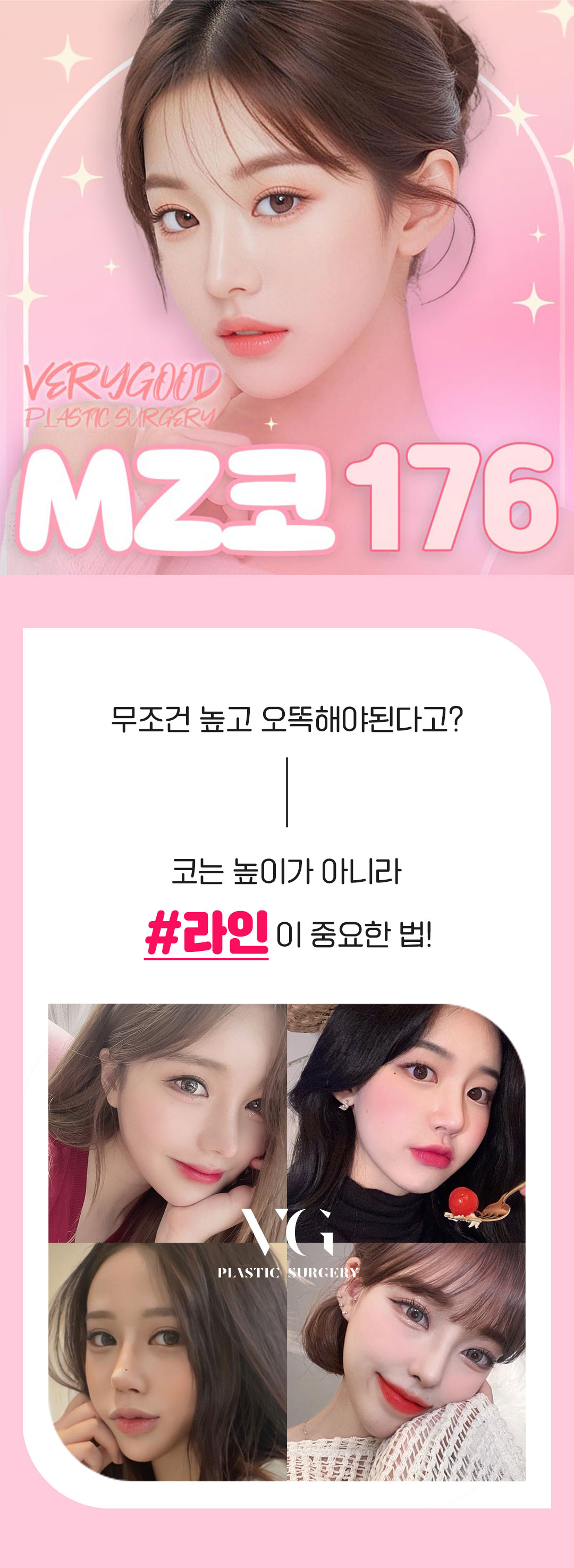 베리굿성형외과의원 베리굿♡MZ코 코성형 이벤트, 시술 상세 이미지