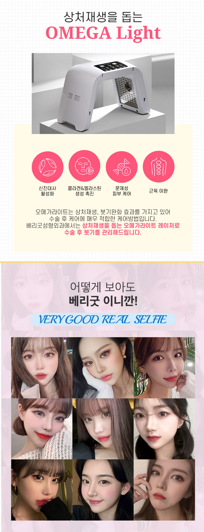 베리굿성형외과의원 베리굿♡MZ코 코성형 이벤트, 시술 상세 이미지