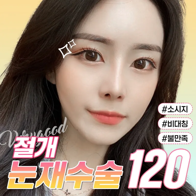 베리굿♡절개 눈재수술 이벤트 썸네일 이미지