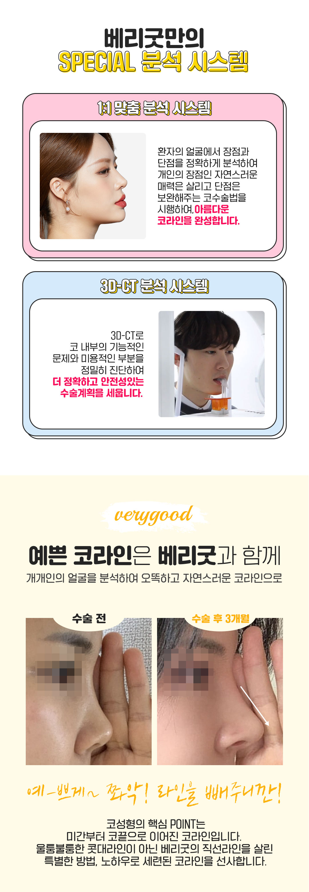 베리굿성형외과의원 베리굿♡MZ코 코성형 이벤트, 시술 상세 이미지