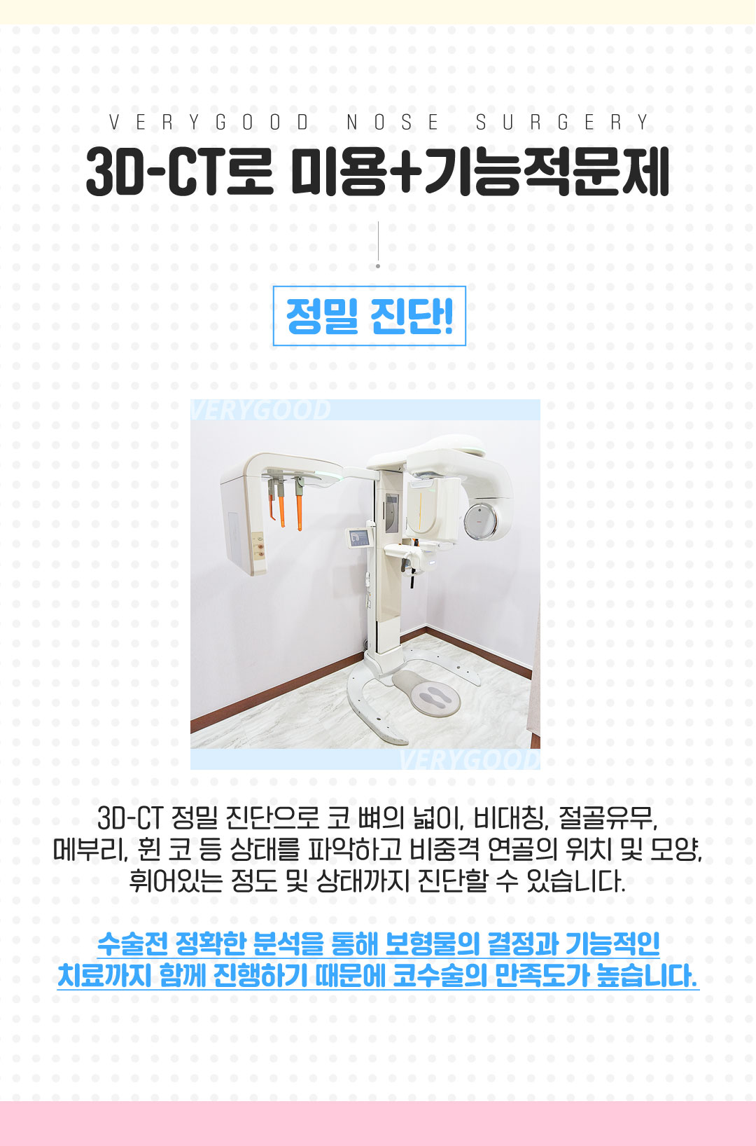 베리굿성형외과의원 베리굿♡MZ코 코성형 이벤트, 시술 상세 이미지