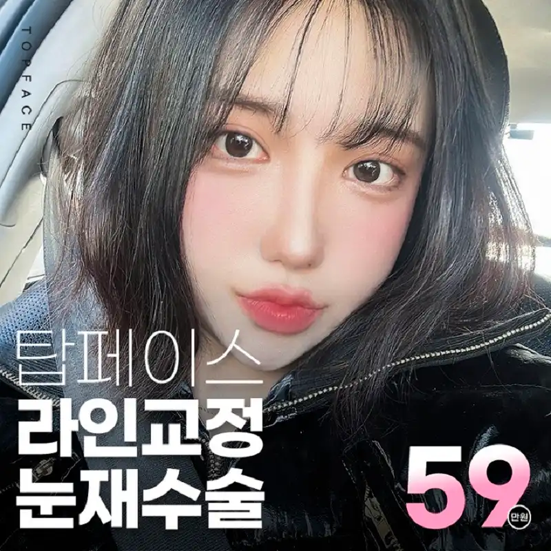 탑페이스성형외과