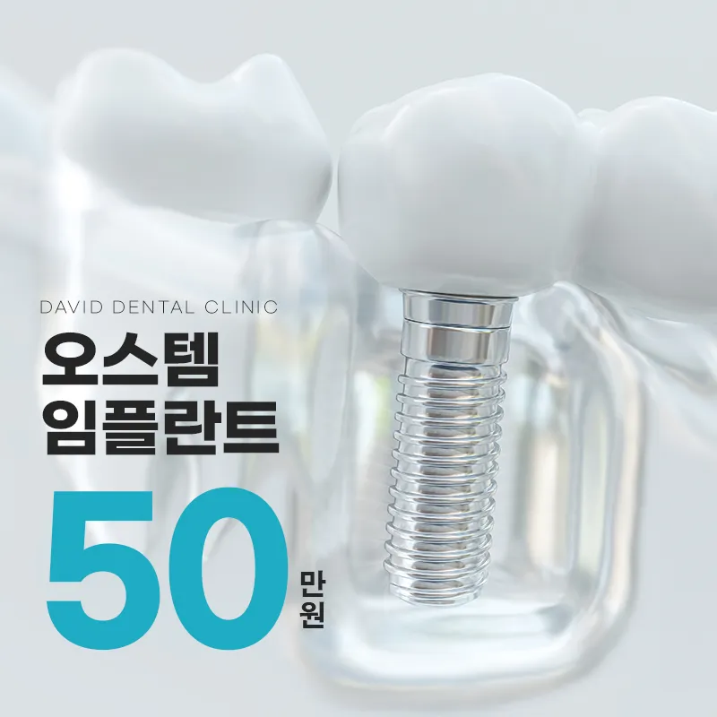 ★오스템 임플란트 50만원★ 이벤트 썸네일 이미지