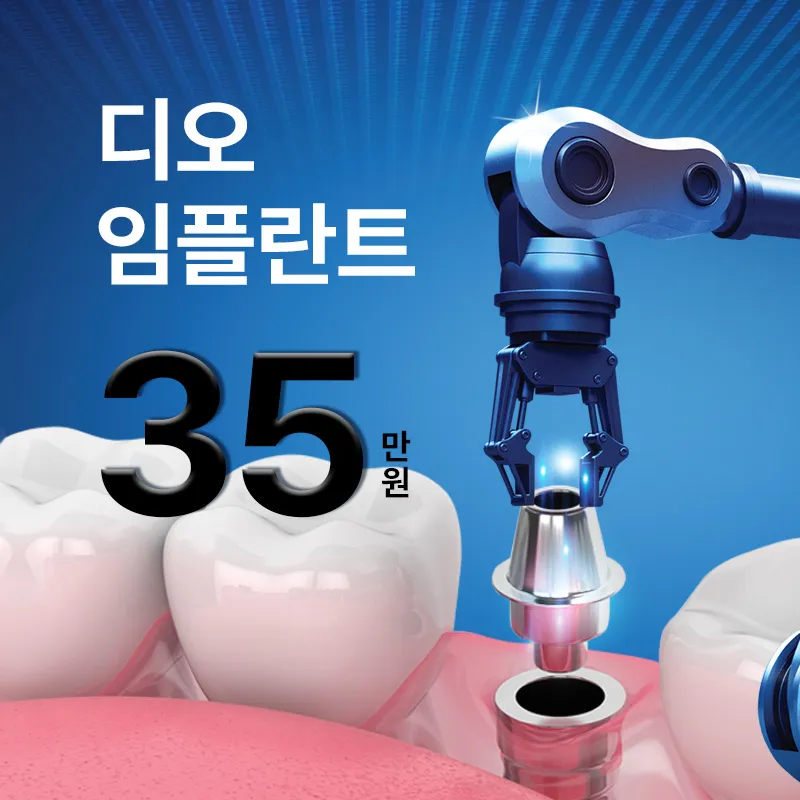 ★디오 임플란트 35만원★ 이벤트 썸네일 이미지