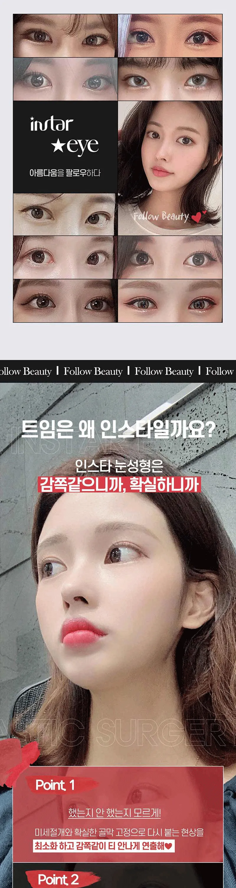 인스타성형외과의원 ❣️인스타❣️감쪽트임❣️ 이벤트, 시술 상세 이미지