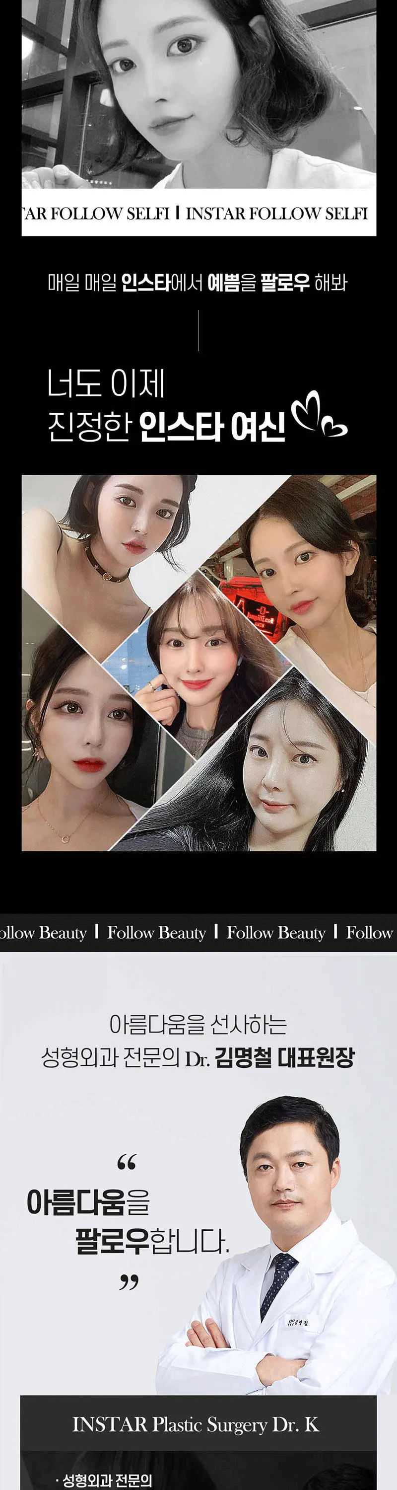 인스타성형외과의원 ❣️인스타❣️감쪽트임❣️ 이벤트, 시술 상세 이미지