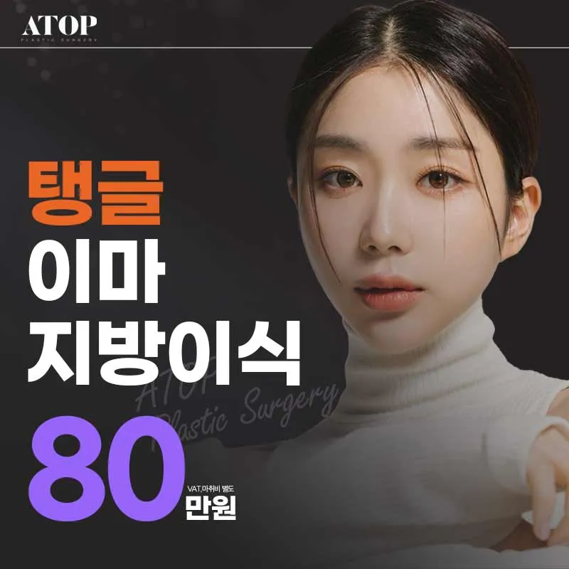 에이탑 탱글 이마지방이식 이벤트 썸네일 이미지