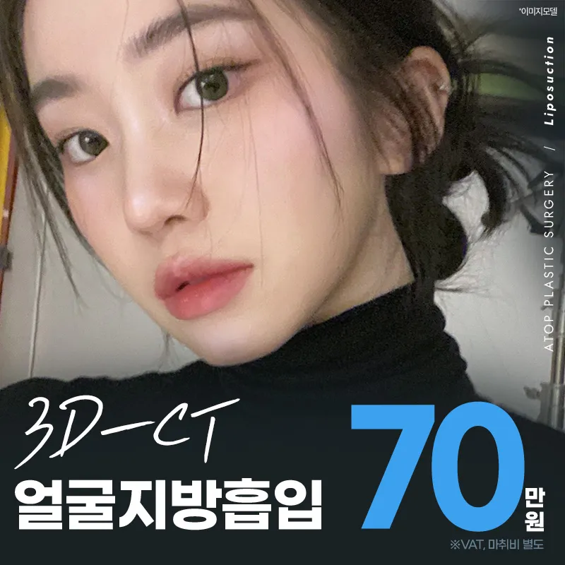 3D-CT 얼굴지방흡입 이벤트 썸네일 이미지