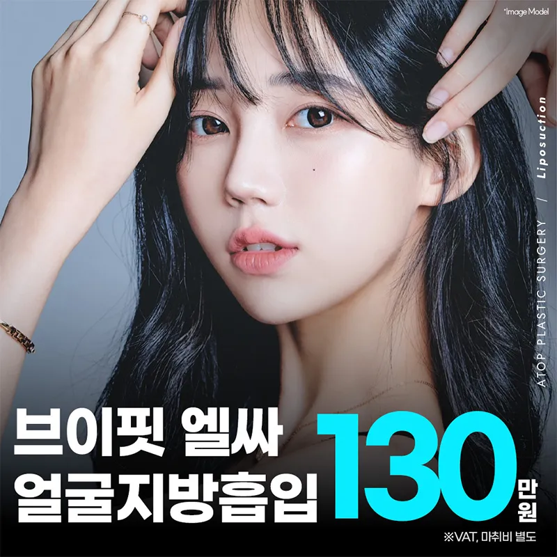 브이핏 엘싸 얼굴지방흡입 이벤트 썸네일 이미지