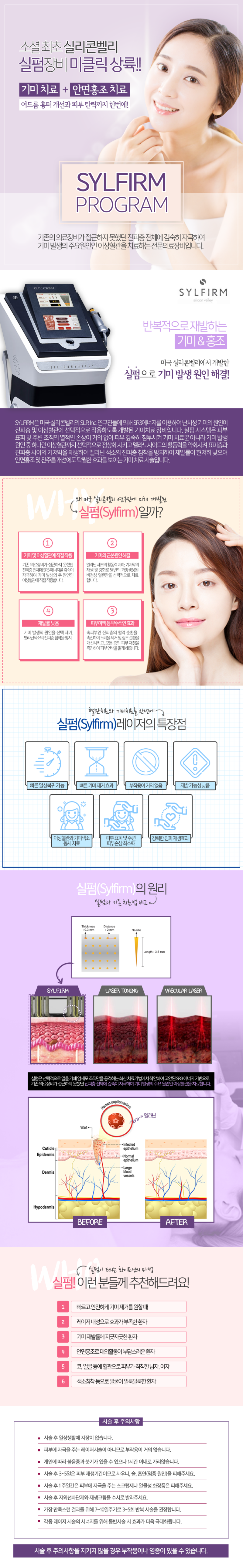 아름다운의원 기미/홍조/혈관에 실펌 이벤트, 시술 상세 이미지