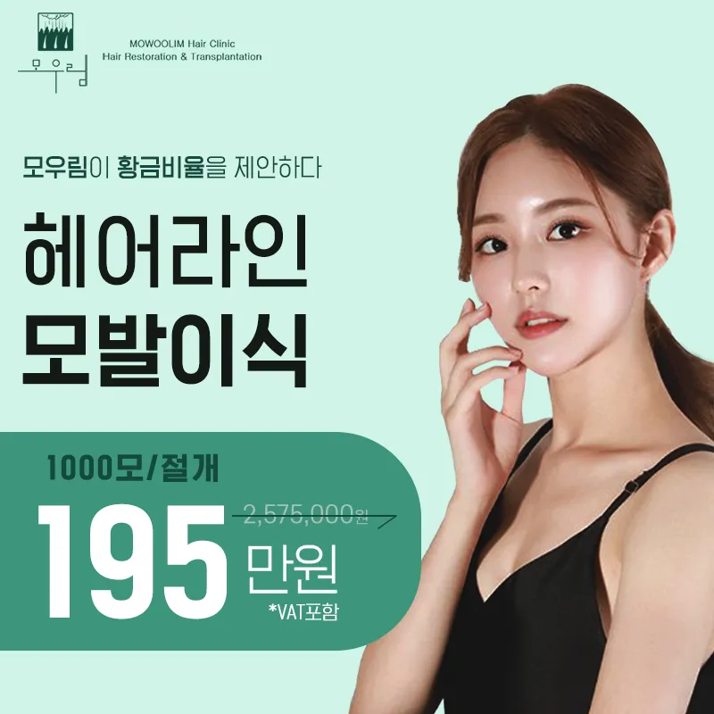 헤어라인 모발이식 1000모 이벤트 썸네일 이미지