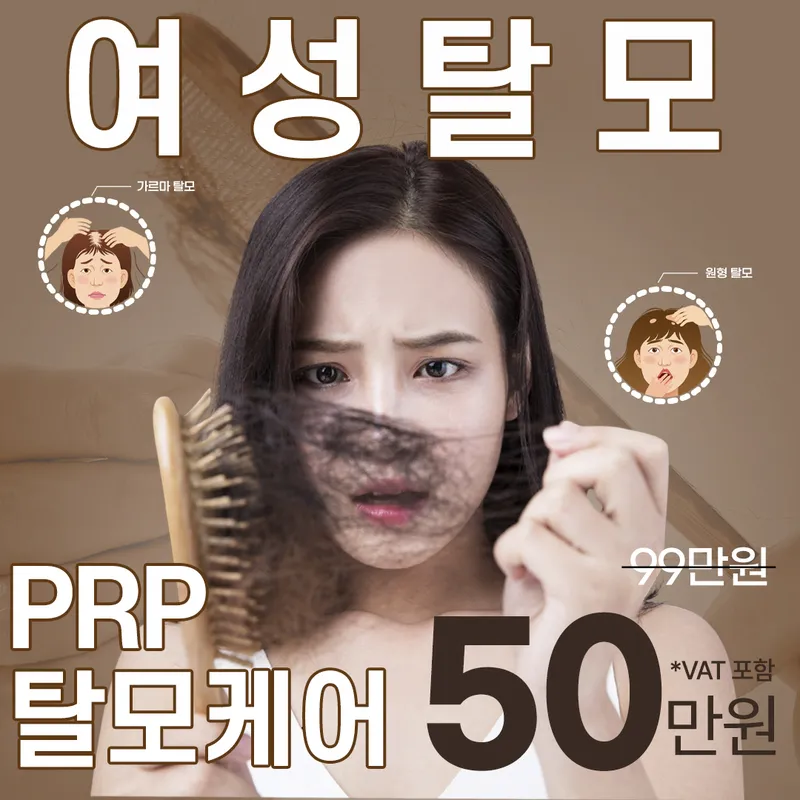 여성 PRP탈모케어 이벤트 썸네일 이미지