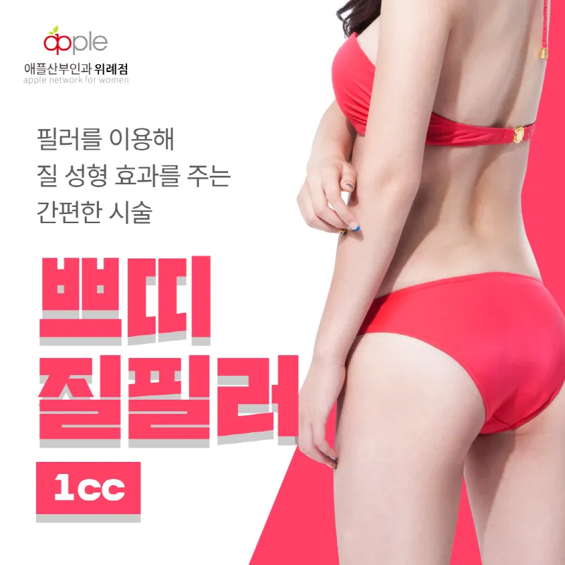 위례점-수술없이 되찾은 자신감!! 이벤트 썸네일 이미지
