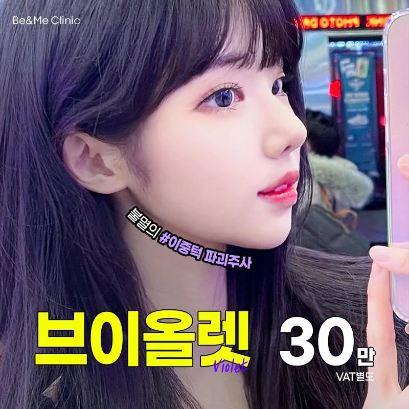 이중턱소멸주사 브이올렛 이벤트 썸네일 이미지