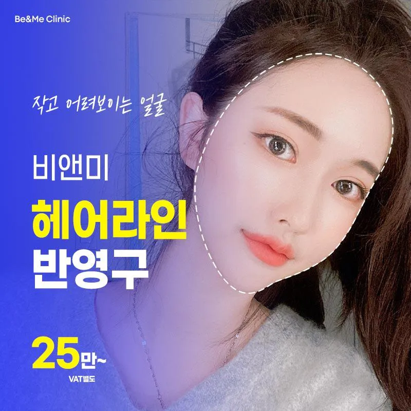 비앤미 헤어라인 반영구 이벤트 썸네일 이미지