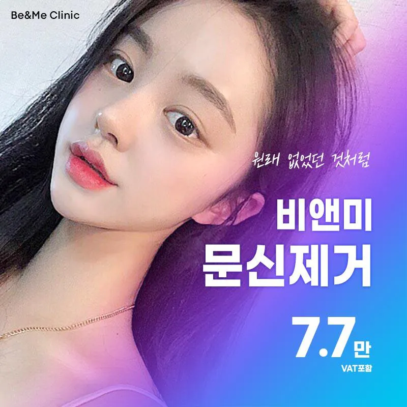 눈썹문신제거 7.7 이벤트 썸네일 이미지