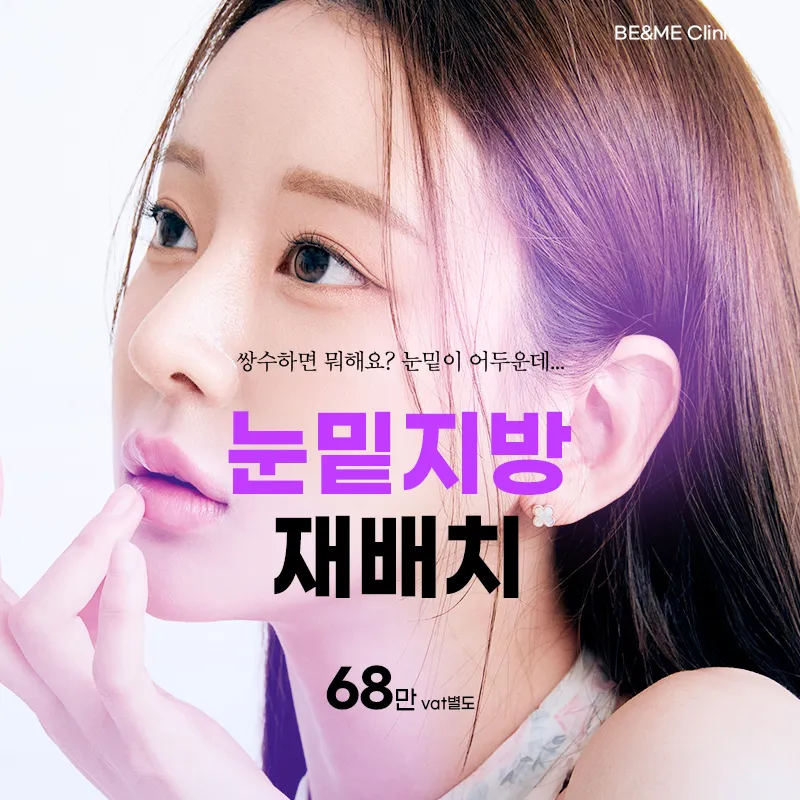 압구정비앤미 눈밑지방재배치 이벤트 썸네일 이미지