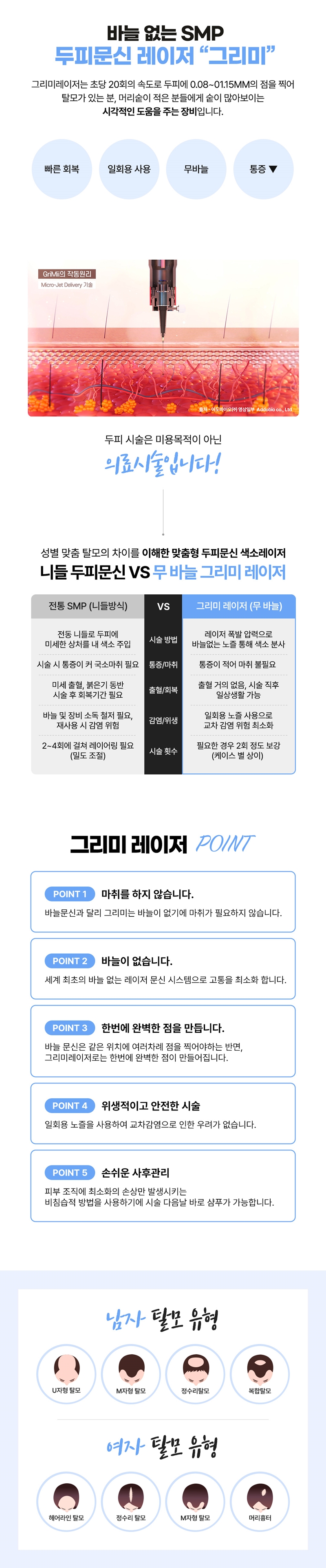 리버스클리닉 강남점 바늘 없는 두피문신레이저 '그리미' 이벤트, 시술 상세 이미지