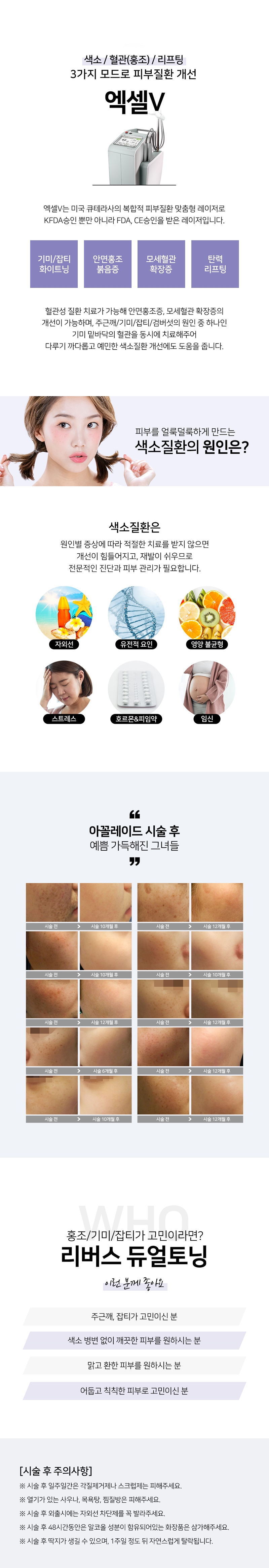 리버스클리닉 수원점 엑셀V듀얼토닝, 아꼴레이드 듀얼토닝 이벤트, 시술 상세 이미지