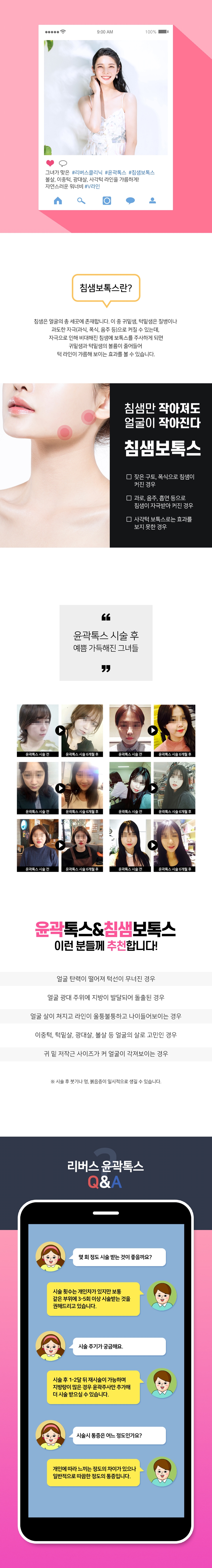리버스클리닉 수원점 수원 윤곽주사X보톡스X침샘보톡스 체험 이벤트, 시술 상세 이미지