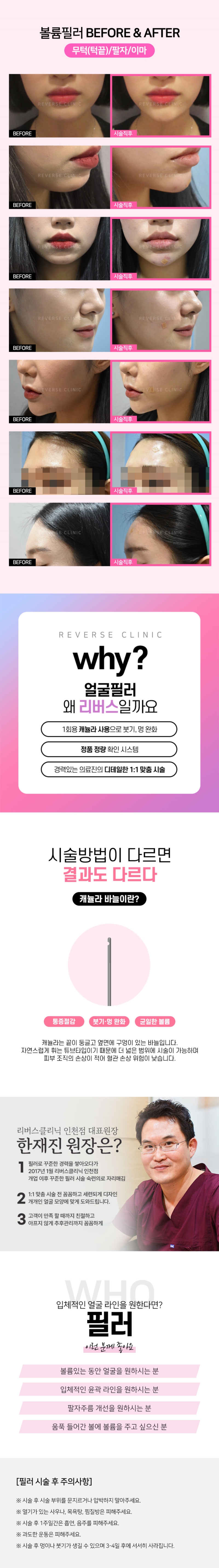 리버스클리닉 인천구월점 필러3ccX주름보톡스2부위 이벤트, 시술 상세 이미지