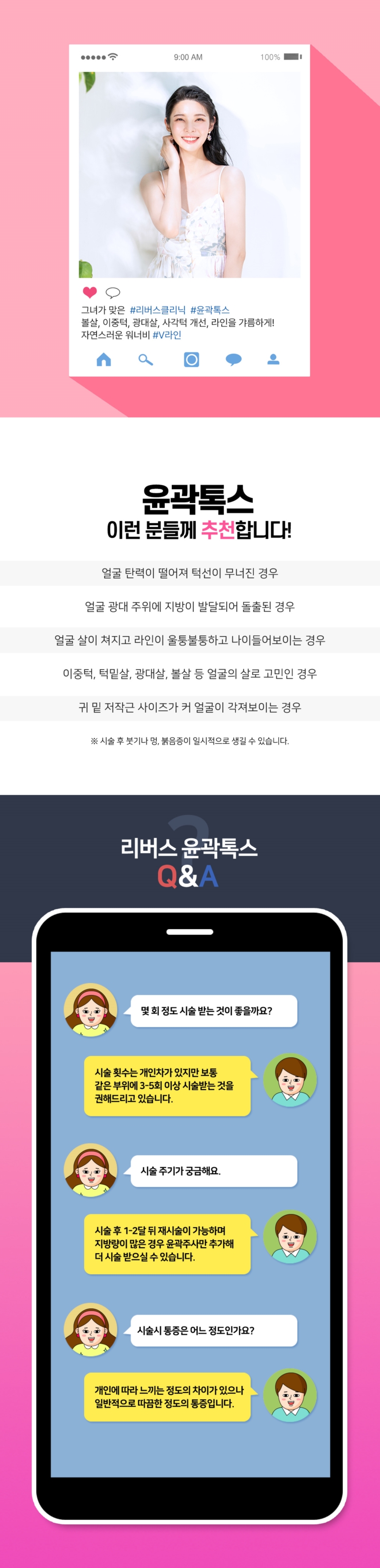 리버스클리닉 인천구월점 사각턱축소 얼굴지방제거 윤곽톡스 이벤트, 시술 상세 이미지