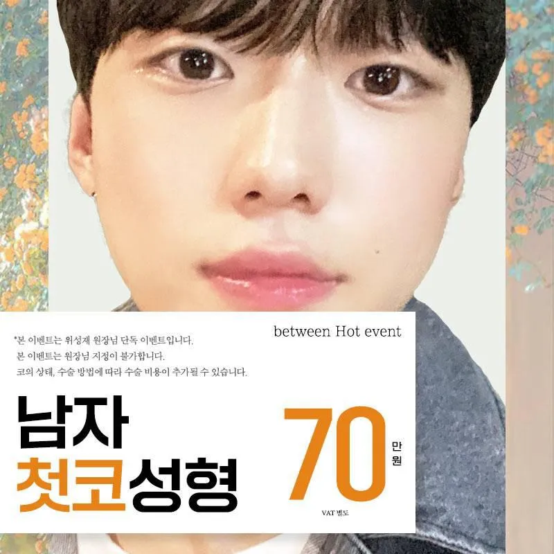비트윈 남성 첫코성형 이벤트 썸네일 이미지