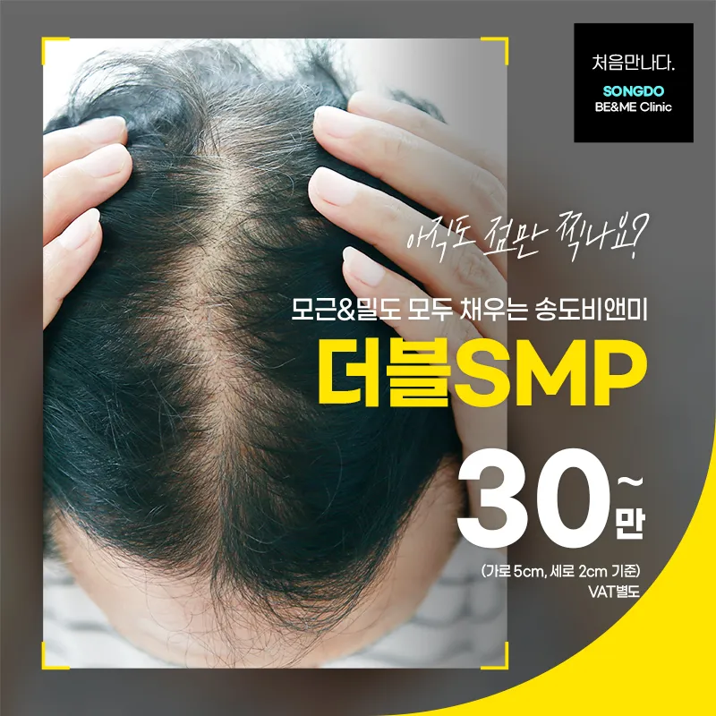 송도비앤미  두피반영구 더블SMP 이벤트 썸네일 이미지